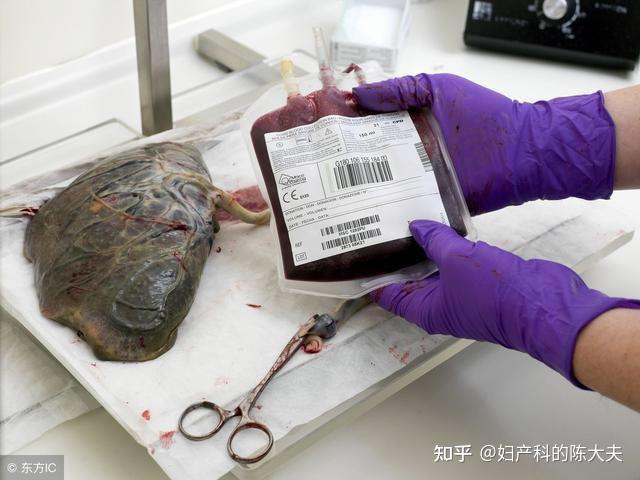 储存脐带血的有用吗(储存脐带血的真相如何?是时候该揭开了)