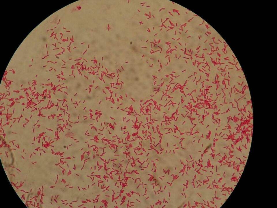 草分枝杆菌培养的简单介绍