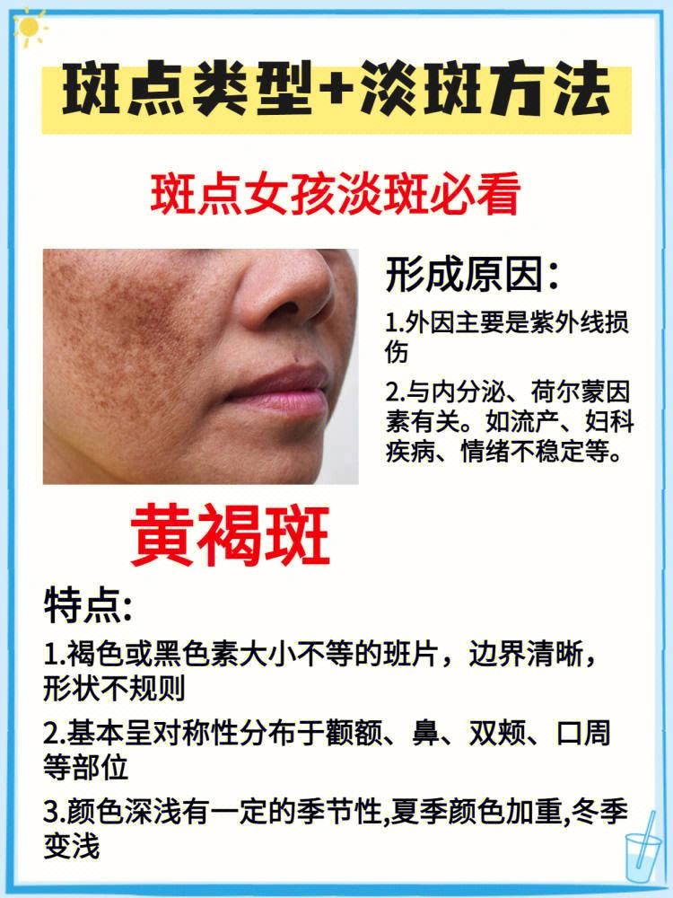 斑的种类及图片和名称(斑的种类及形成原因图片)