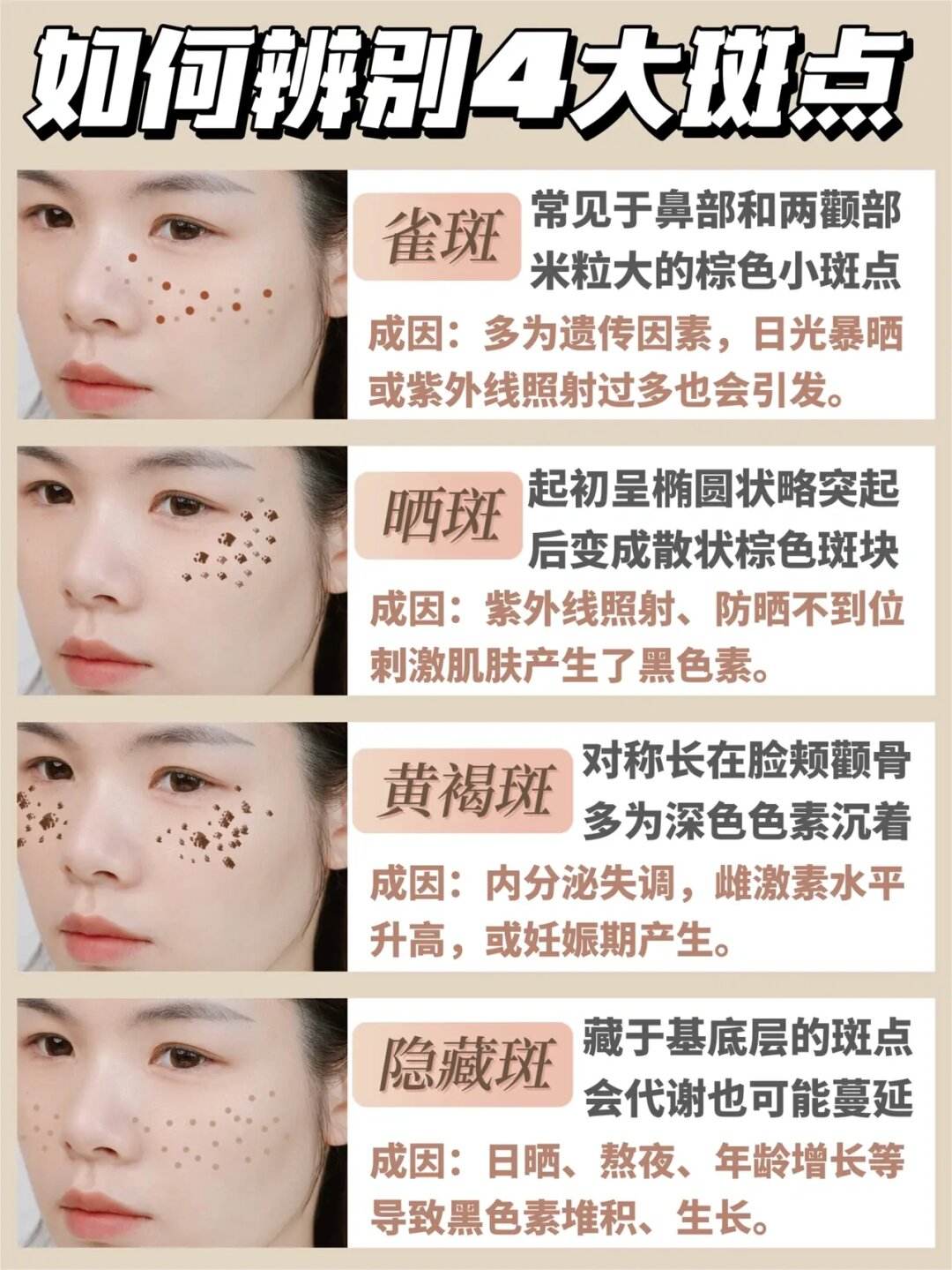 斑的种类及图片和名称(斑的种类及形成原因图片)