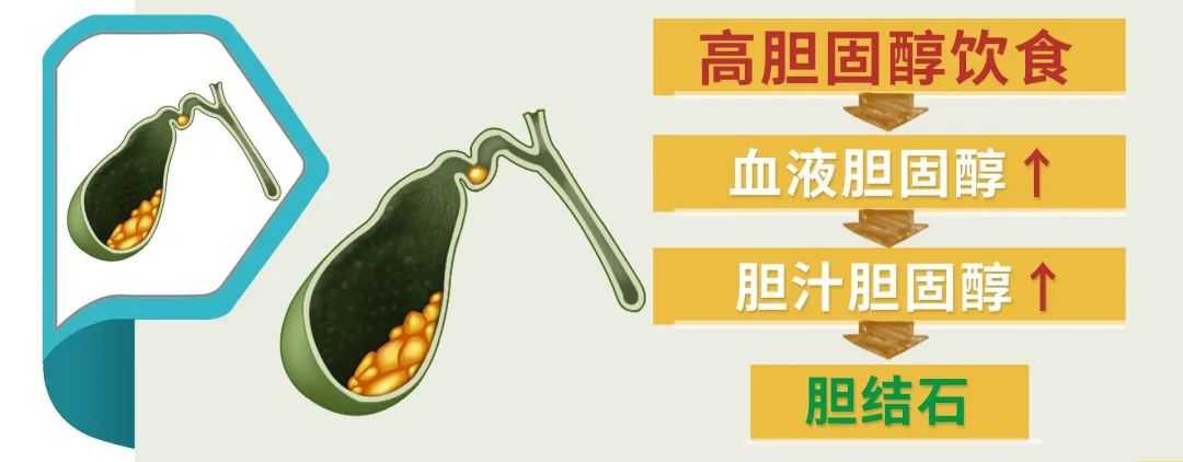胆固醇储存在哪里(胆固醇在身体里的形成和储存)