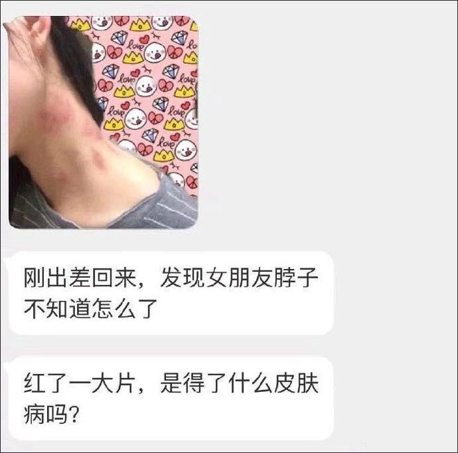 乳房可以种草莓吗(女生胸部能种草莓吗)