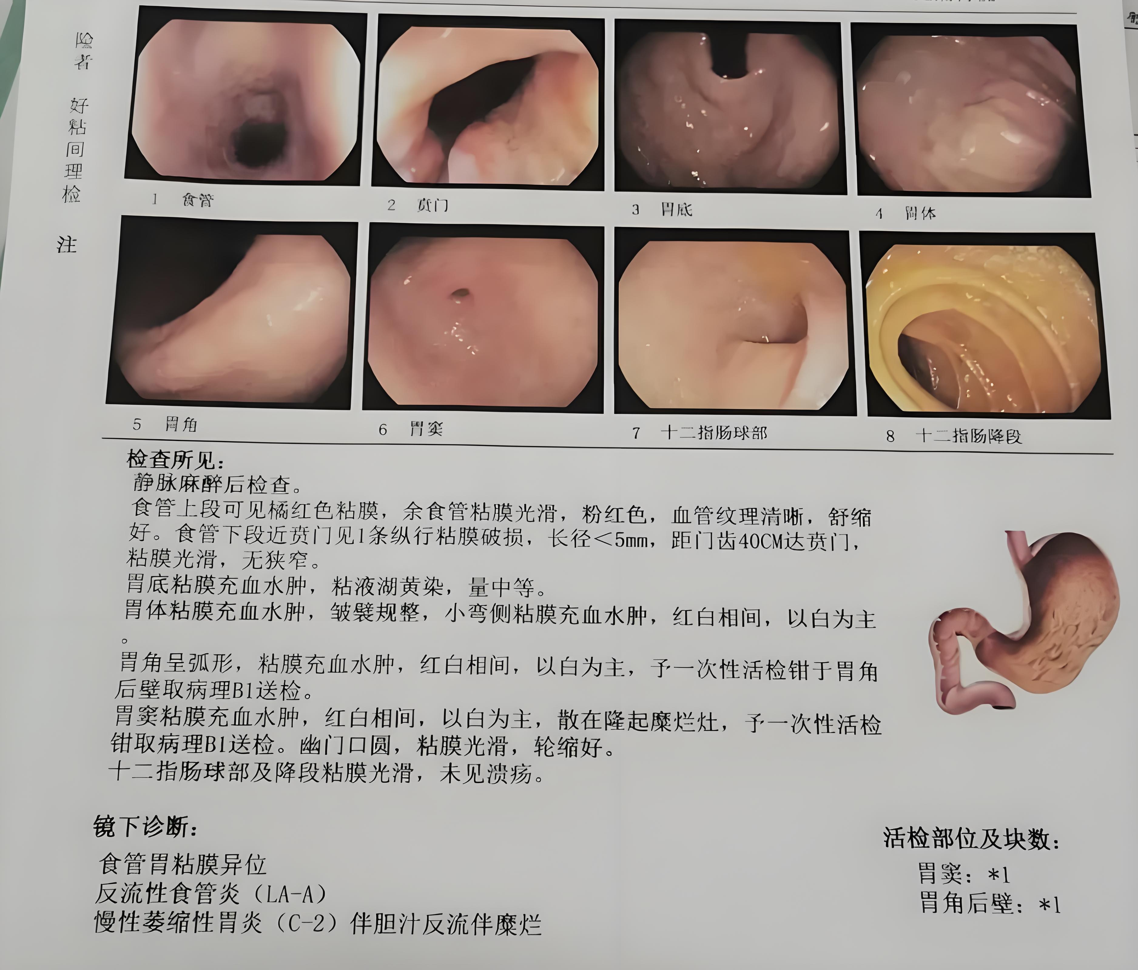 10种胃病种类(10种胃病种类怎么治)